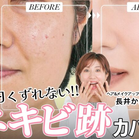 長井かおりが出演する、『美的』youtube【ニキビ＆ニキビ跡カバー法】カバーしてもすぐ出てくる敏感肌のニキビトラブル撃退！多色コンシーラーパレット使いこなし術！ が公開されました。